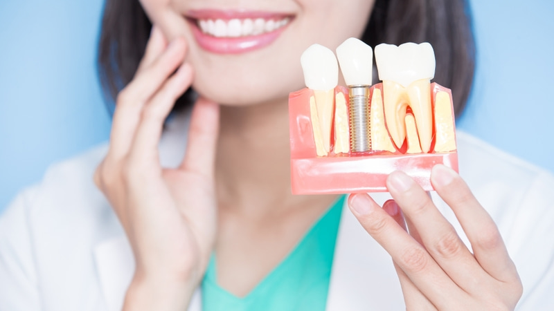 Trồng răng Implant có bị hôi miệng không và cách khắc phục Kỹ thuật cấy ghép đúng sẽ ngăn ngừa hôi miệng hiệu quả