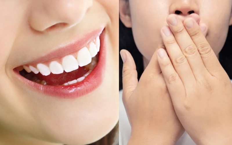 Bọc răng sứ có bị hôi miệng không? Cách khắc phục hiệu quả Hoàn toàn có thể xử lý tình trạng bọc răng sứ bị hôi miệng