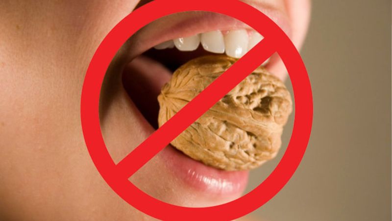 Quy trình bọc răng sứ titan diễn ra như thế nào? Lưu ý an toàn Không cắn vật cứng để bảo vệ an toàn và tăng tuổi thọ của răng sứ titan