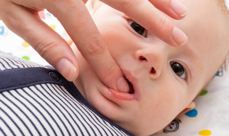 Thuốc giảm đau mọc răng cho bé và những rủi ro cần biết Thuốc bôi dạng gel hoặc kem giúp gây tê tại chỗ và giảm đau tạm thời