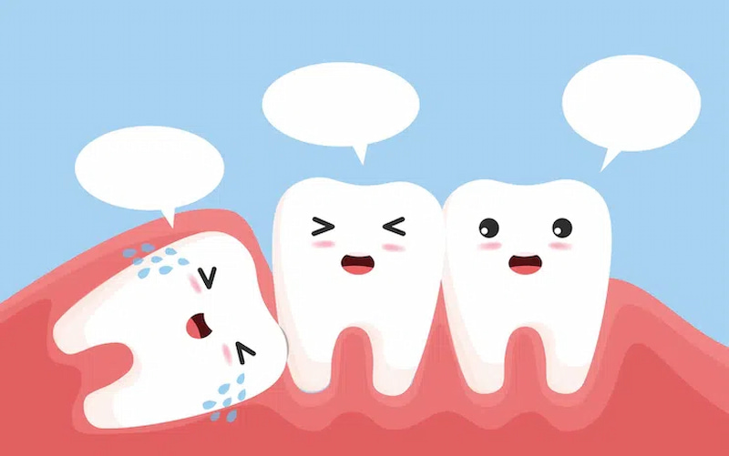 Có nên nhổ răng số 8 không? Khi nào nhổ là tốt nhất Nếu răng số 8 có dấu hiệu mọc lệch nhưng chưa gây biến chứng thì nhổ là tốt nhất