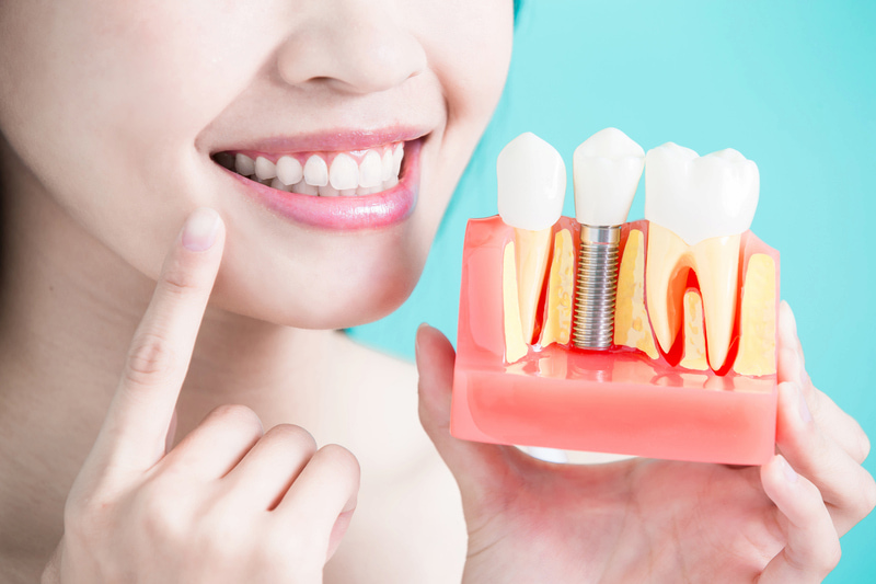 Nhổ răng cấm bao nhiêu tiền? Các yếu tố ảnh hưởng đến chi phí Nên trồng lại răng sau khi nhổ răng cấm càng sớm càng tốt