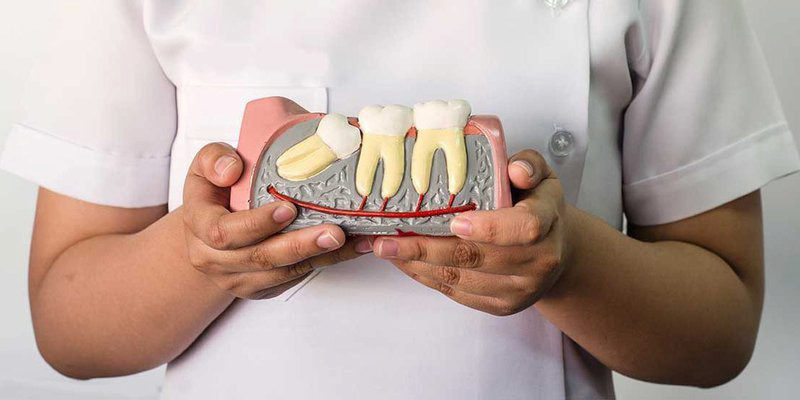 Nhổ răng khôn bao lâu thì lành? Cách để vết thương nhanh lành Trong khoảng 1 - 2 tuần vết thương do nhổ răng sẽ lành lại