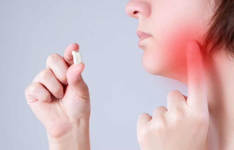 Nhổ răng khôn bị sưng có nguy hiểm không? Bao lâu thì hết? Nhổ răng khôn bị sưng là phản ứng tự nhiên hoàn toàn bình thường