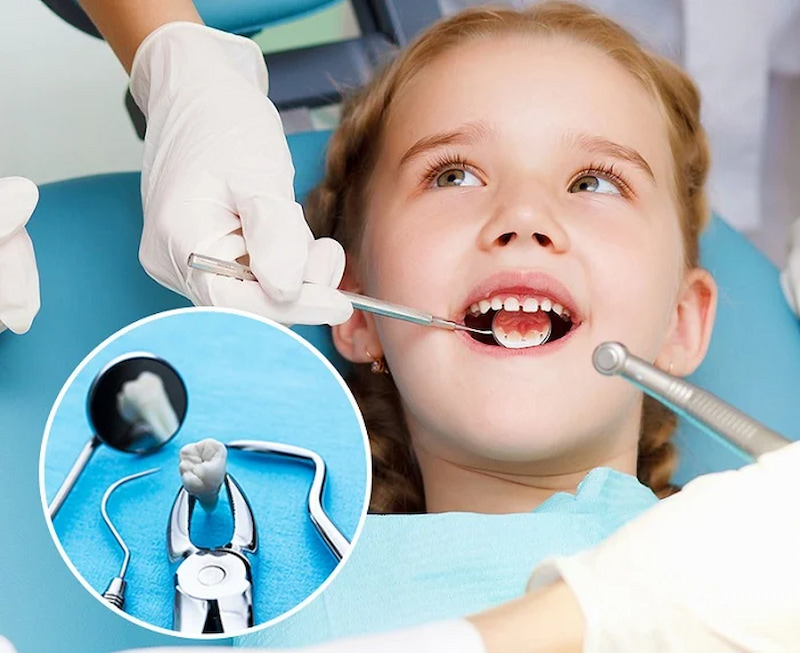 Nhổ răng sữa bao nhiêu tiền? Yếu tố ảnh hưởng đến chi phí Chọn cơ sở nha khoa uy tín để tránh phát sinh thêm chi phí