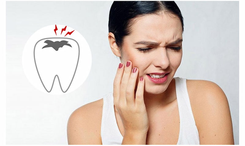 Nhổ răng sâu số 8 hàm trên có cần không? Khi nào nên nhổ? Nhổ răng số 8 bị sâu không gây nguy hiểm khi thực hiện tại nha khoa uy tín