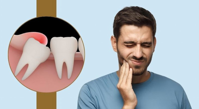 Nhổ răng số 8: Khi nào cần nhổ? Những lưu ý cần nhớ Khi răng số 8 mọc lệch, mọc ngầm nên nhổ