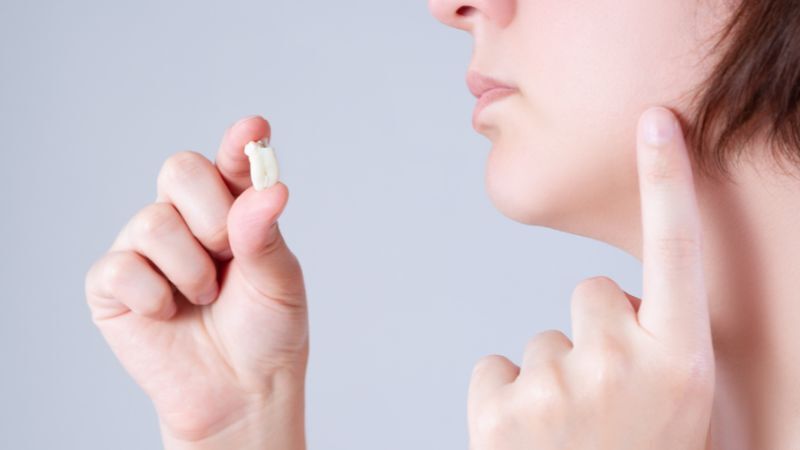 Hướng dẫn vệ sinh răng miệng sau khi nhổ răng khôn đúng cách Vệ sinh răng miệng sau nhổ răng khôn hoàn toàn cần thiết