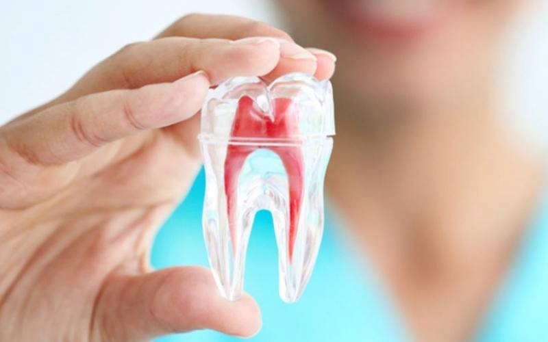 Bọc răng sứ có cần nhổ răng không? Trường hợp cần nhổ răng Trường hợp răng đã chữa tủy vẫn có thể bọc sứ mà không cần nhổ răng